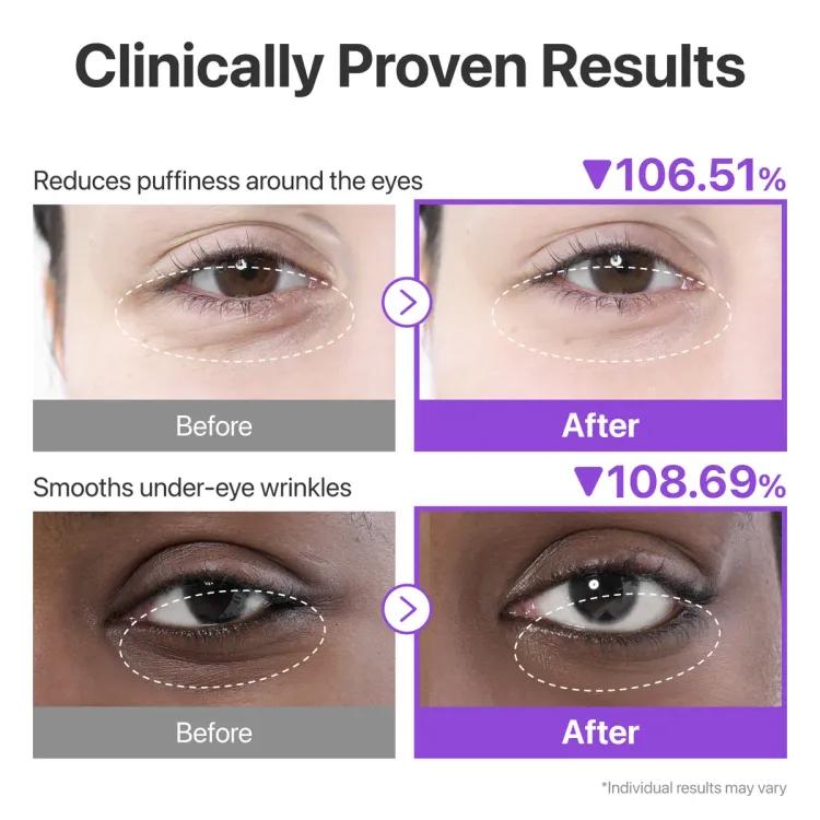 Numbuzin No9 Nad+ Collagen Under Eye Patches 1ea