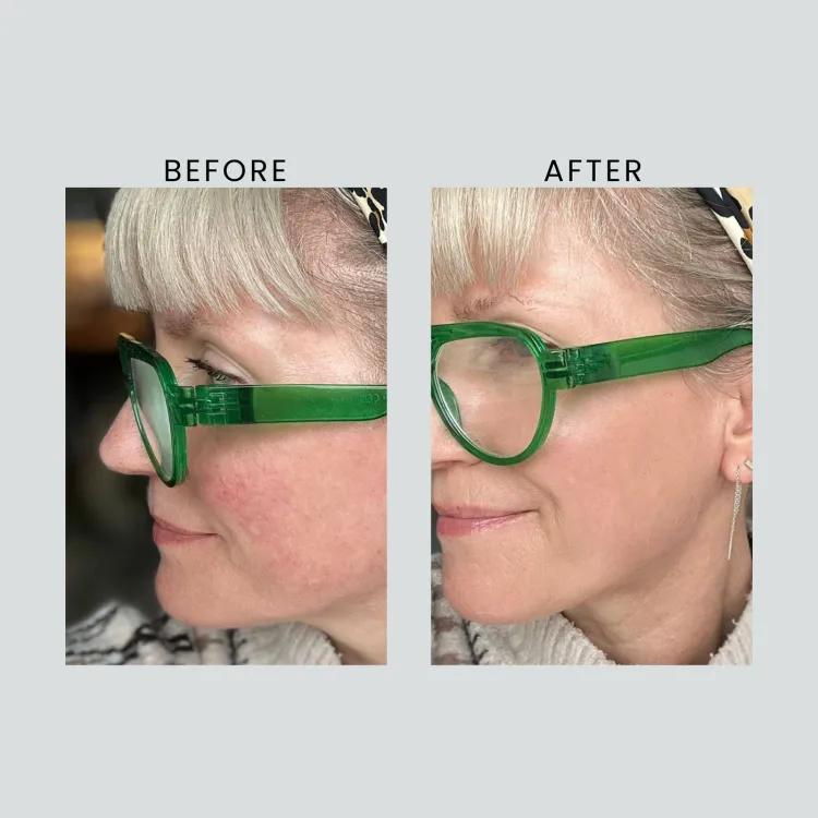 Altruist Anti Redness And Pigmentation Light Spf50 30ml