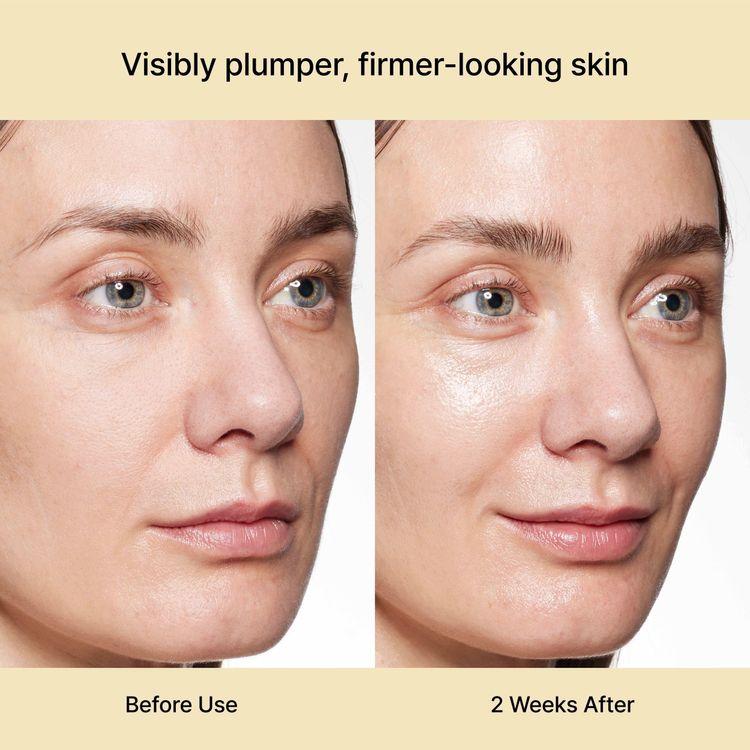 Rejuran Dual Effect Ampule 30ml