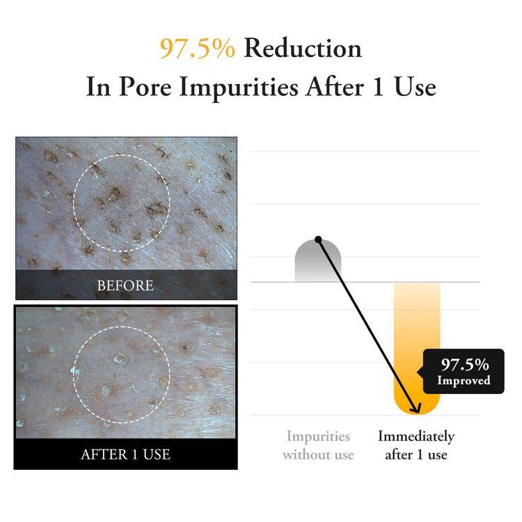 Aprilskin Calendula Peel Off Mask 100g