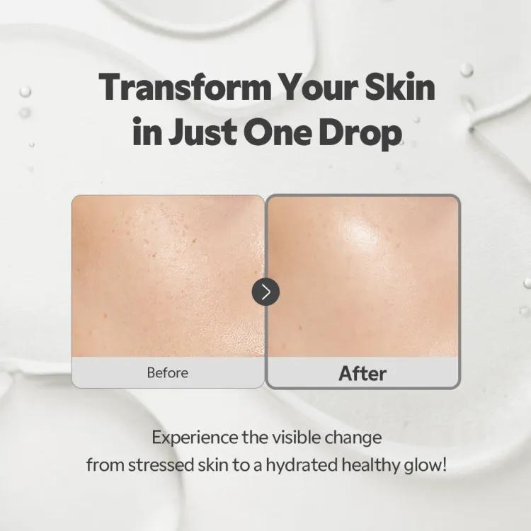 Tirtir Sos Serum 50ml