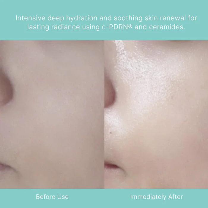 Rejuran Turnover Mask 40 Ml