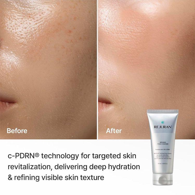 Rejuran Refining Foam Cleanser 120ml