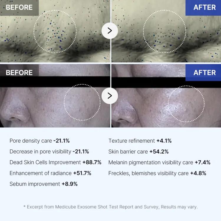 Medicube One Day Exosome Shot Pore