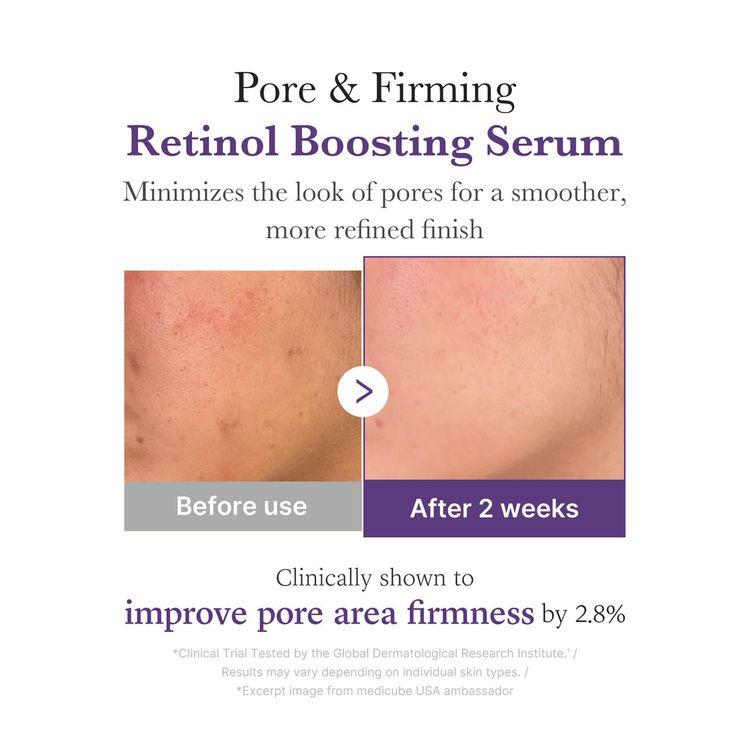 Medicube Retinol Nmn Boosting Serum 30ml